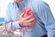 Diclofenaco se asocia con un mayor riesgo de eventos cardiovasculares