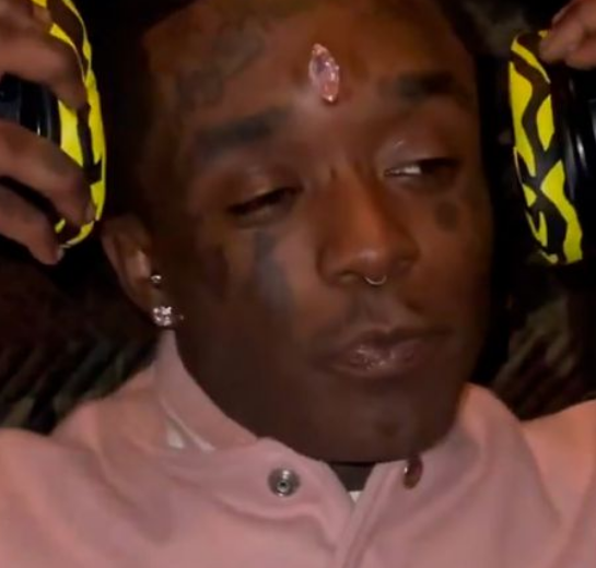 El rapero Lil Uzi Vert se implanta en la frente un diamante de 24 millones de dólares (videos)