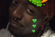 Fans del rapero Lil Uzi Vert le arrancan el diamante de 24 mdd que se implantó en la frente