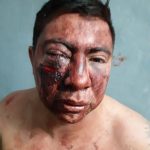 El Profesor Sergio Delgado denuncia brutal agresión en su contra por parte de policías en Venustiano Carranza